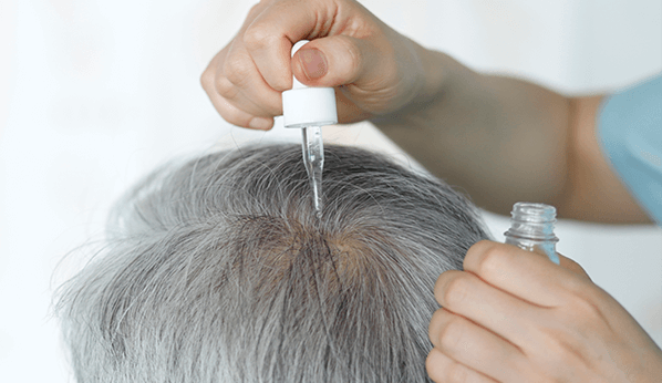 Qué causa pérdida de cabello? | MinuteClinic